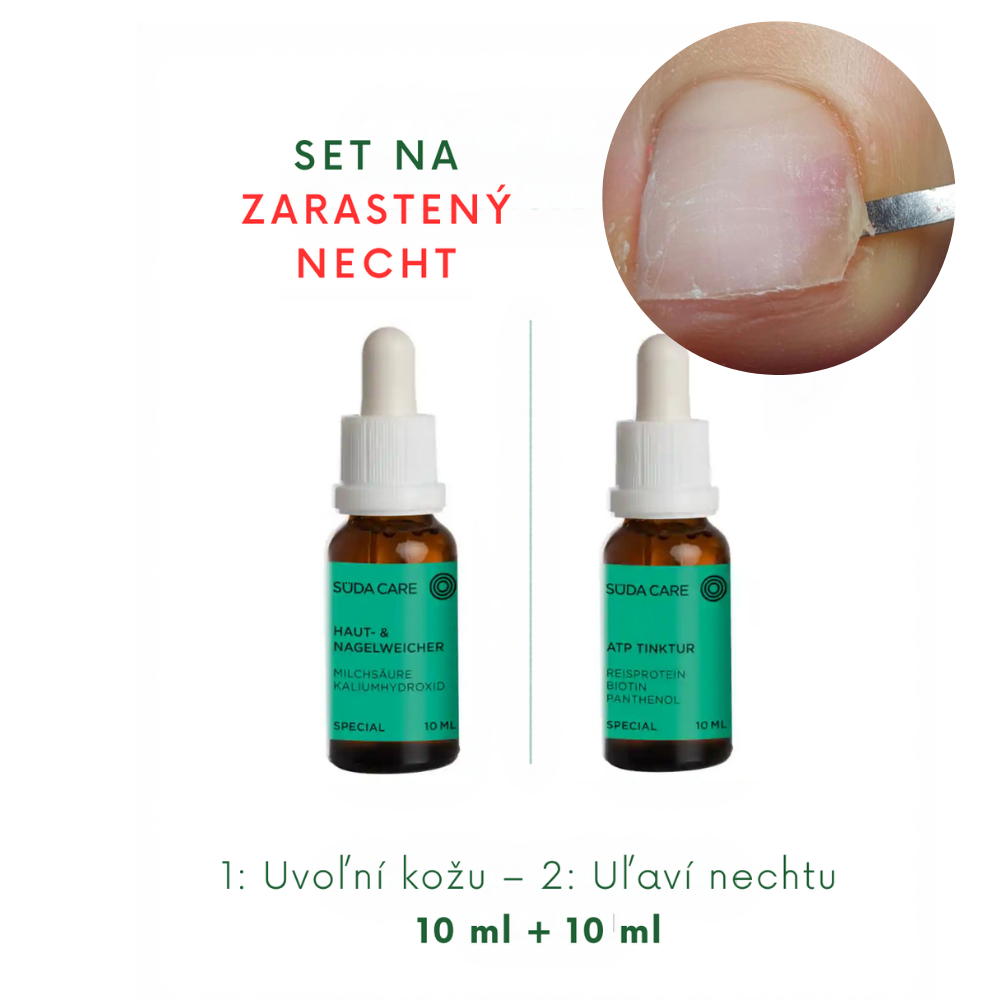 SÜDA CARE set na zarostlý nehet – změkčovač pokožky a nehtů a ATP tinktura Set na zarostlý nehet – změkčení a zklidnění (10 ml + 10 ml) - Obrázek 1